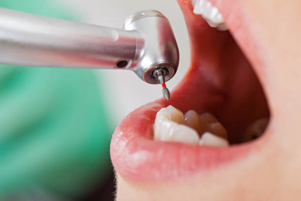 Best 24-Hour Emergency Dentist in Honeygo, MD